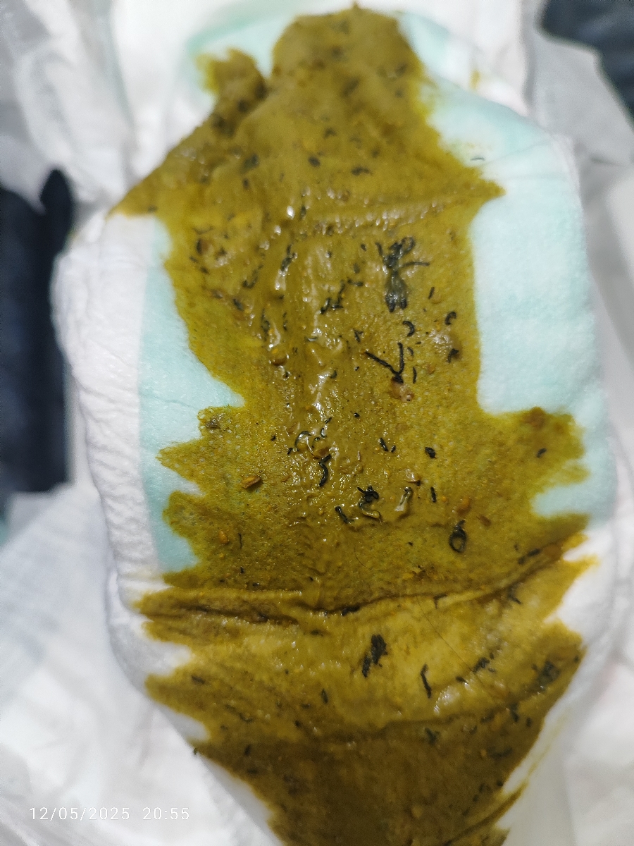 مدفوع سبز و سیاه بعد از شروع غذا و قطره آهن