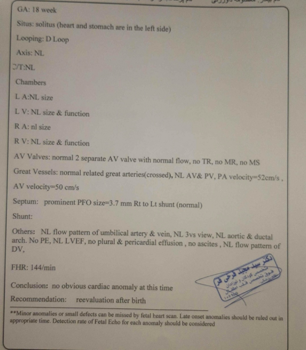 تفسیر آنومالی و اکوی قلب جنین تفسیر آنومالی و اکوی قلب جنین