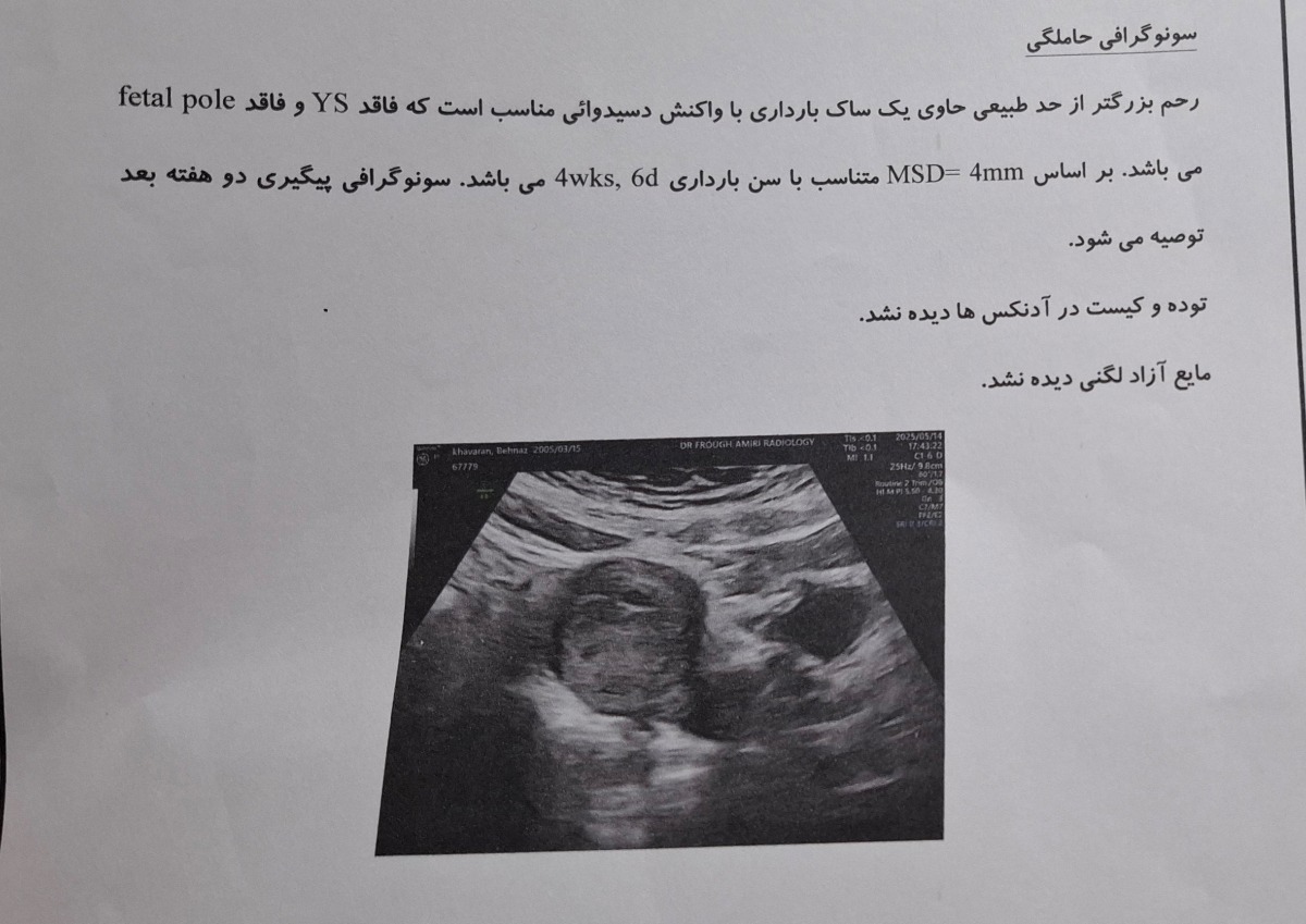 تفسیر سونوگرافی بارداری و لکه بینی تفسیر سونوگرافی بارداری و لکه بینی