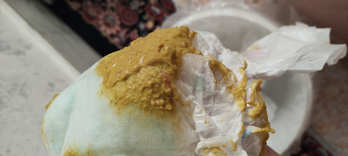 رگه خونی داخل مدفوع نوزاد