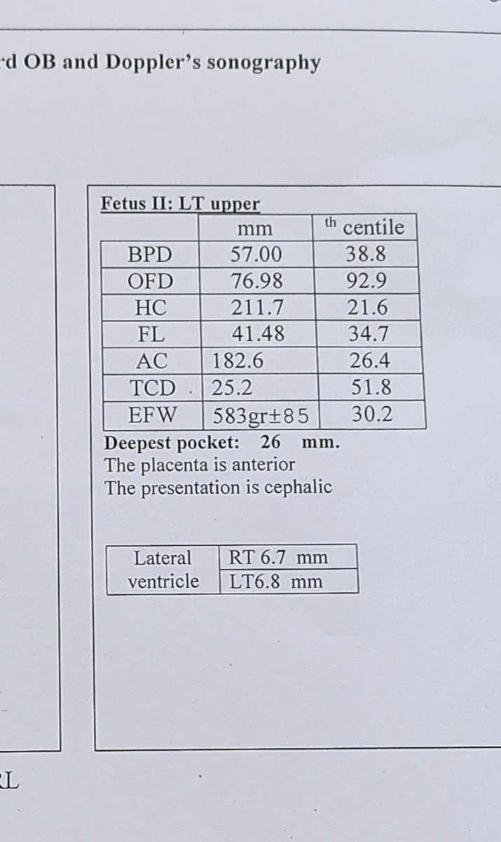 آب دور جنین در سونوOB کدام است؟؟؟