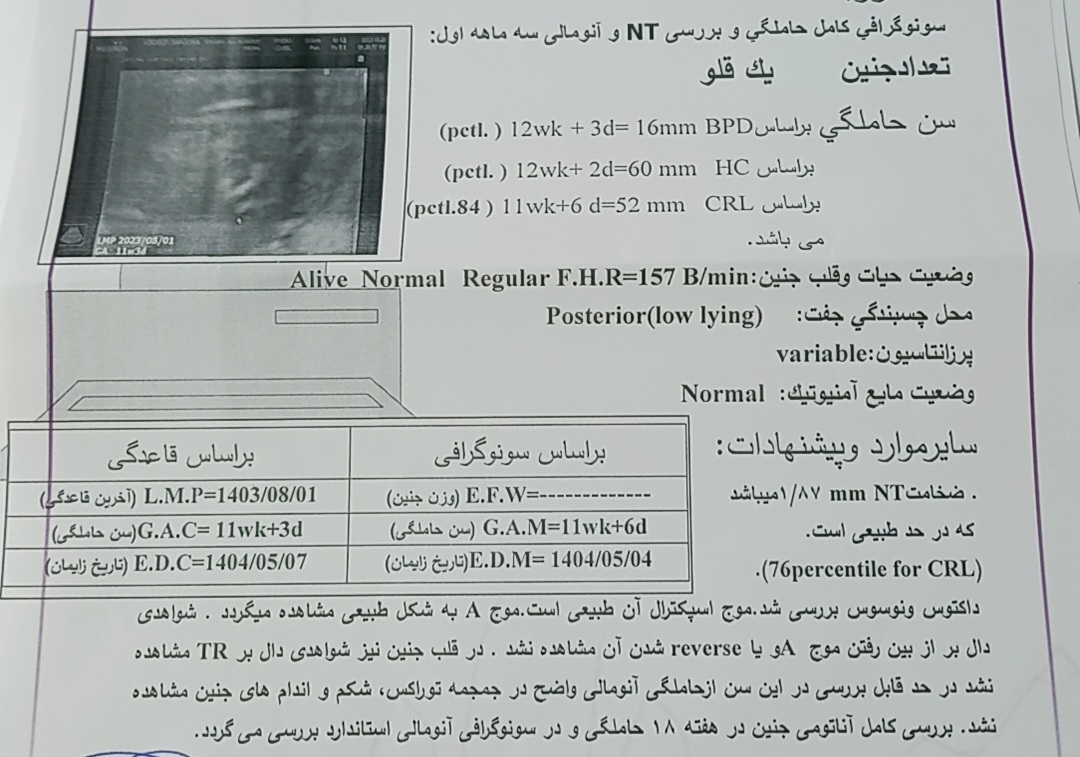 تفسیر سونو گرافی بارداری
