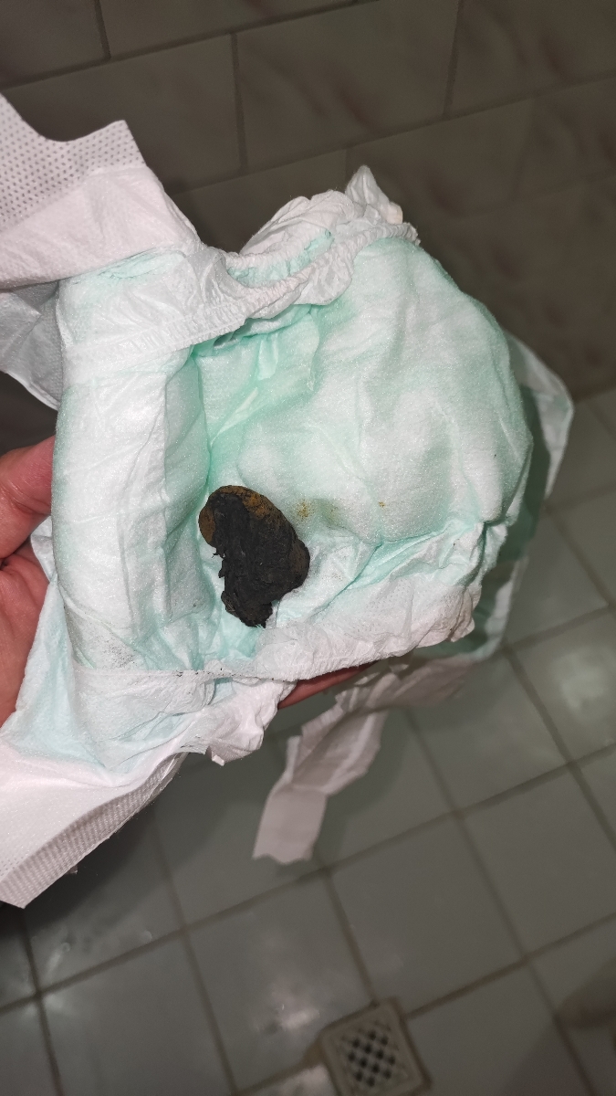 یبوست و قرمزی مقعد یبوست و قرمزی مقعد