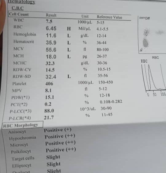 تفسیر آزمایش خون کودک ۳ساله+عکس
