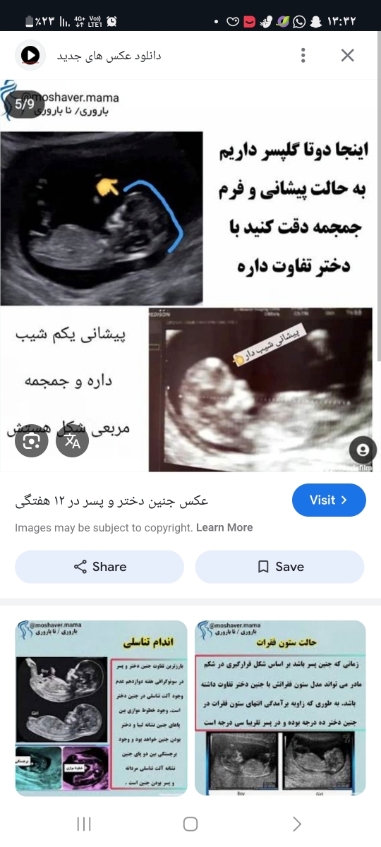 جنسیت جنین از روی عکس سونو