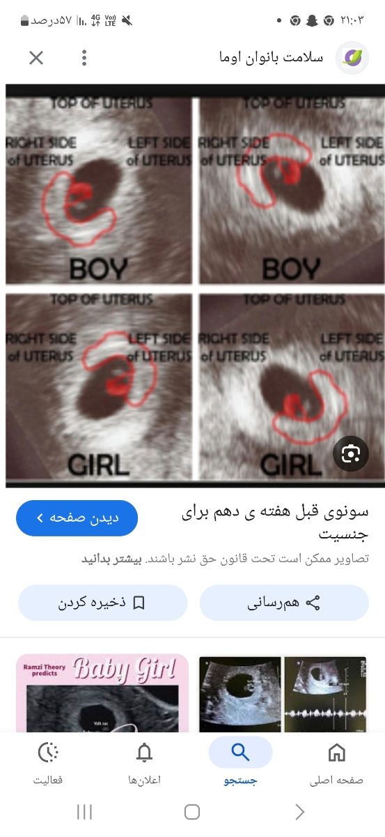 سمت چپ یا راست بودن ساک تاثیری تو جنسیت داره یا نه ؟ سمت چپ یا راست بودن ساک تاثیری تو جنسیت داره یا نه ؟