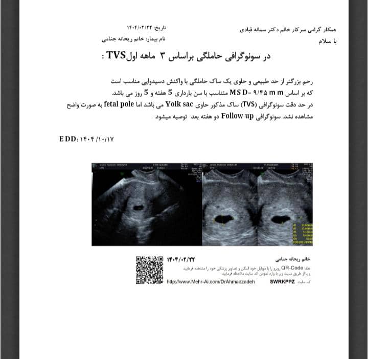 سنوی اول سنوی اول