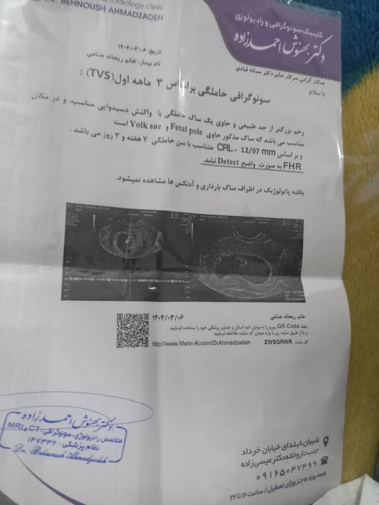سنوی امروز سنوی امروز