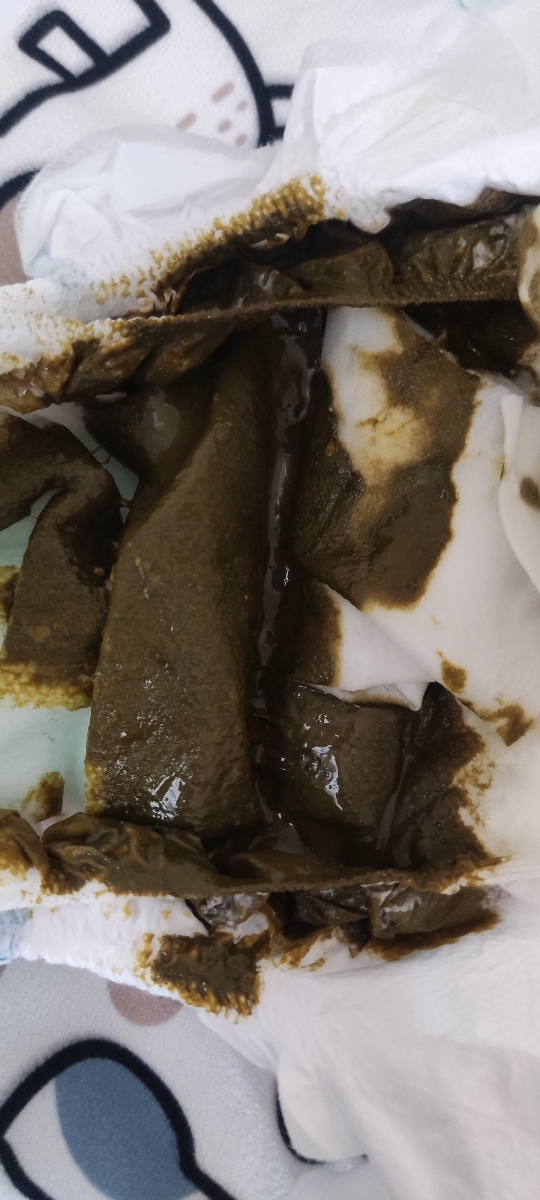 مدفوع نوزاد سه ماهه حاوی عکس مدفوع نوزاد سه ماهه حاوی عکس
