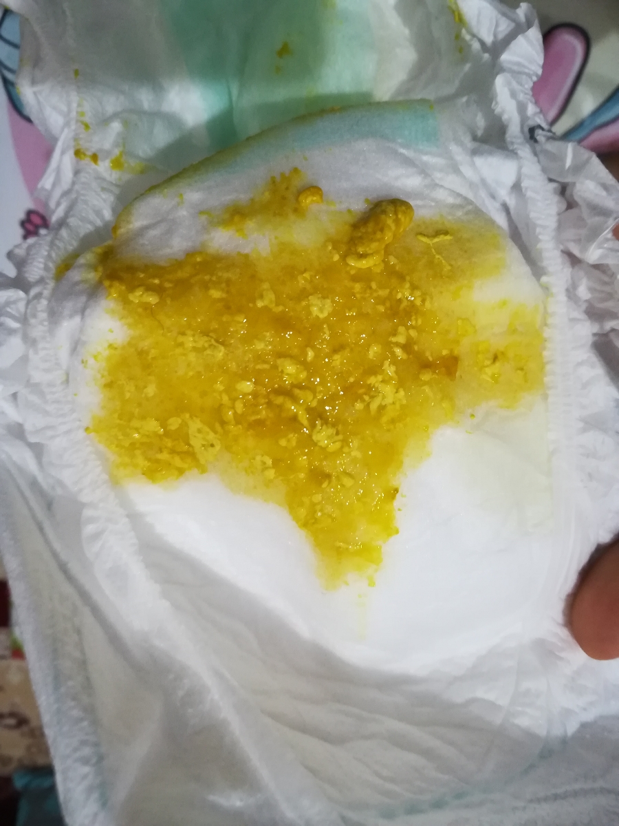 سلام مامانا خوبین شبتون بخیر ببخشید هرکی بدش نمیاد یه نگاه به مدفوع میندازه