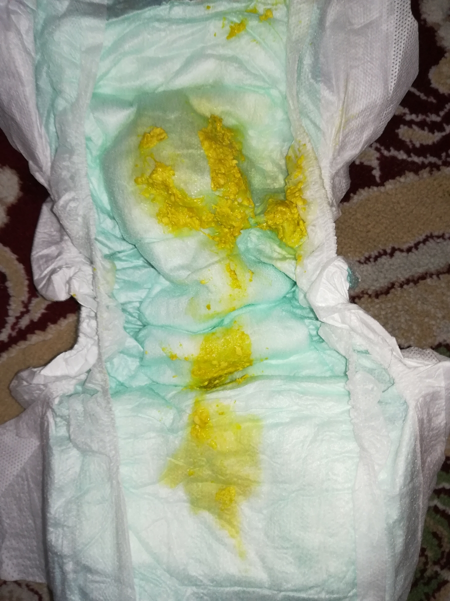سلام مامانا خوبین شبتون بخیر ببخشید هرکی بدش نمیاد یه نگاه به مدفوع میندازه
