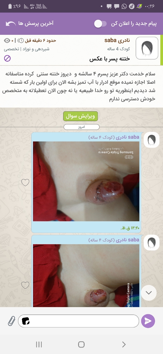 سلام دکتر لطفا اورژانسی جواب بدید ممنون