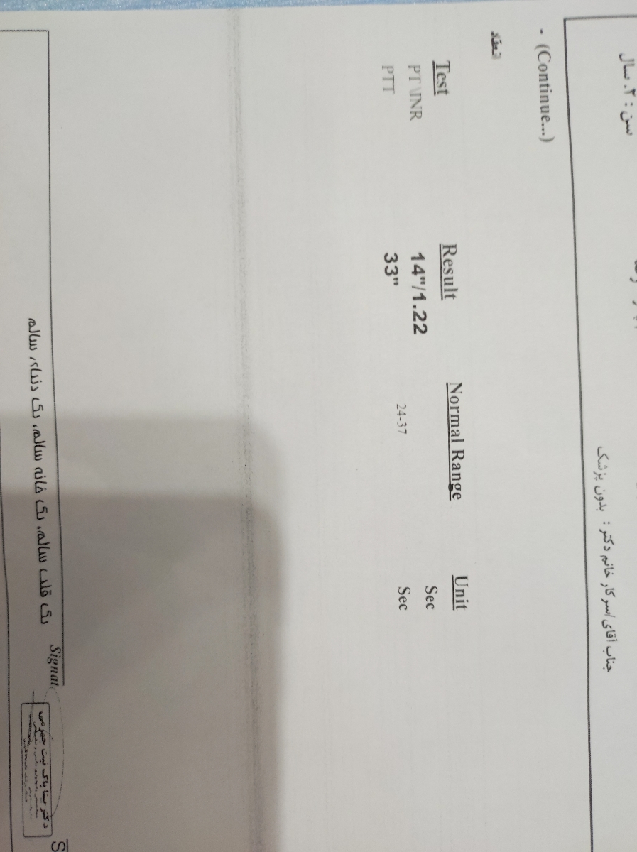فوووووری (خوردن قرص کابرگولین ۱ میلی توسط کودک) فوووووری (خوردن قرص کابرگولین ۱ میلی توسط کودک)