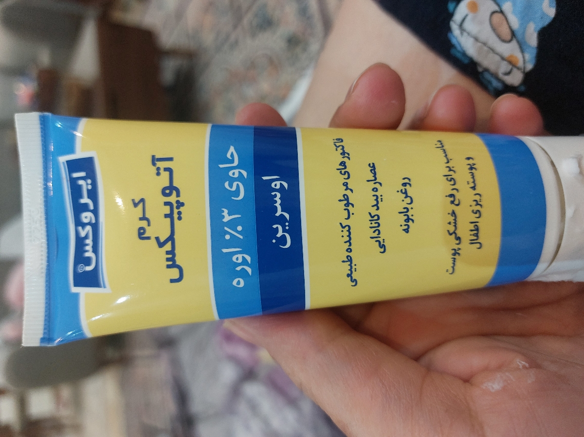 خشکی پوست صورت نوزاد خشکی پوست صورت نوزاد