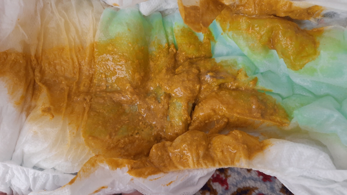 مدفوع بچم از دیروز خلطی شده دلیلش چیه؟؟؟ مدفوع بچم از دیروز خلطی شده دلیلش چیه؟؟؟