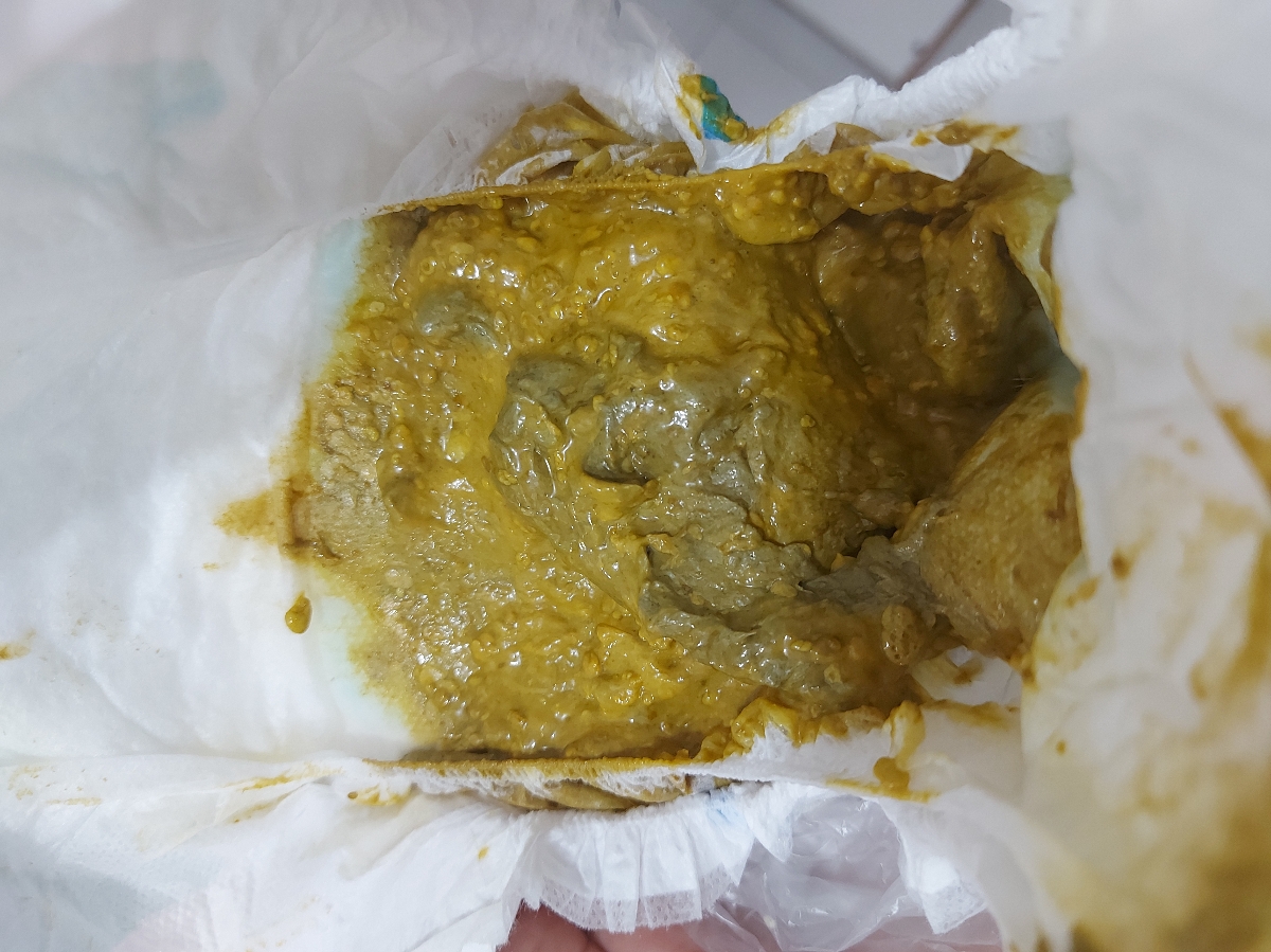 مدفوع طبیعی نوزاد ۳ماهه