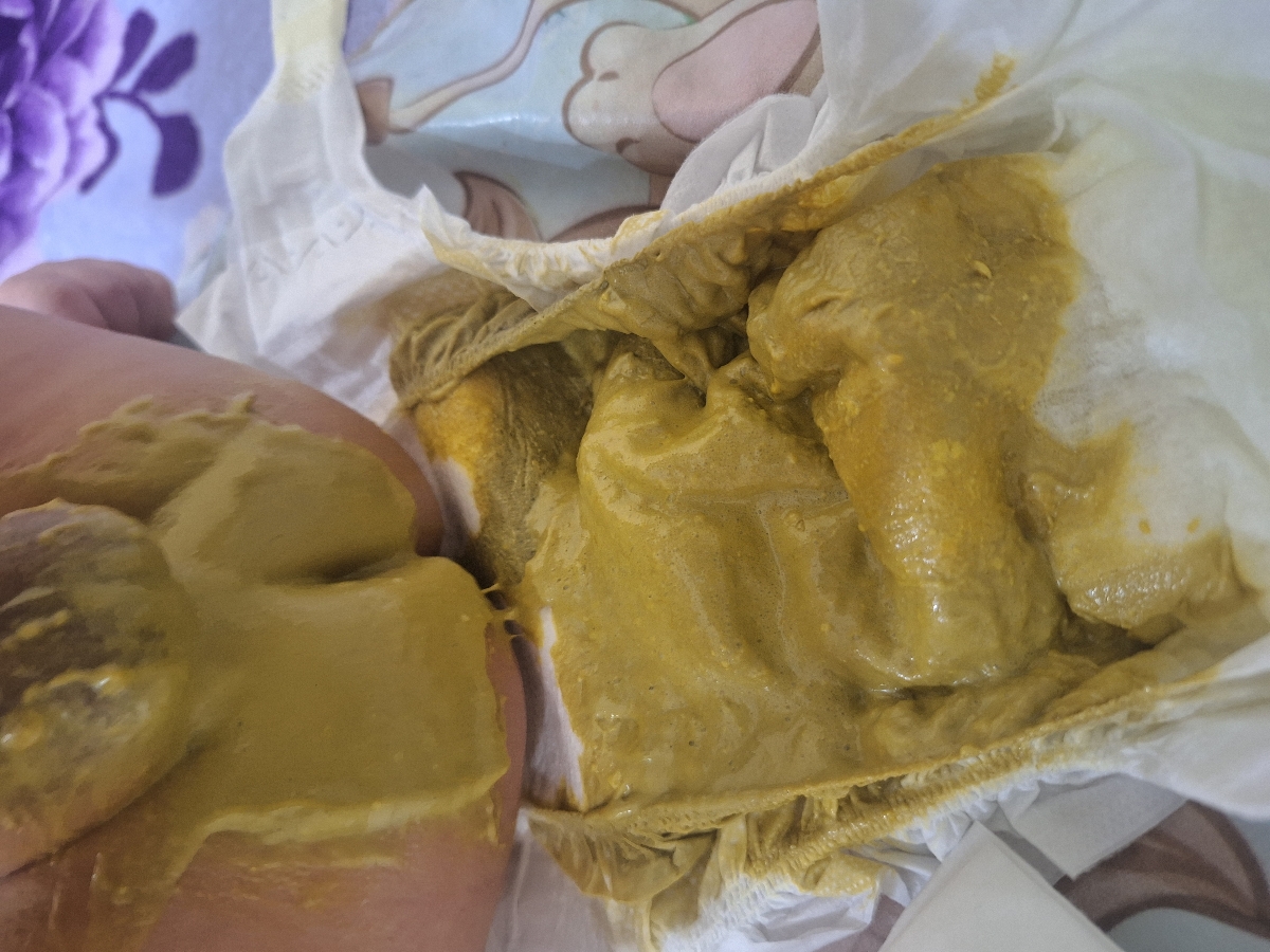 مدفوع نرمال نوزاد مدفوع نرمال نوزاد