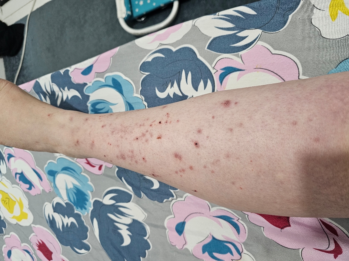 این یکی از پاهای منه این یکی از پاهای منه