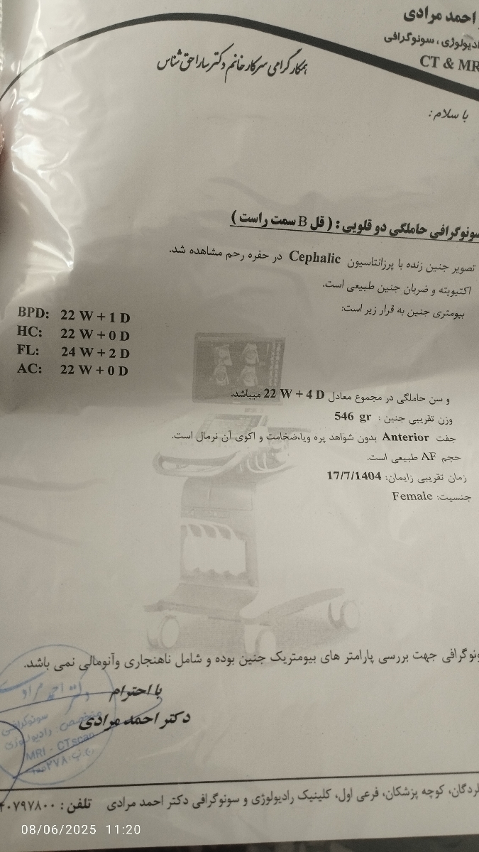 خانم دکتر وخانمایی که دوقلو باردارین بیاید لطفا نگرانم!! خانم دکتر وخانمایی که دوقلو باردارین بیاید لطفا نگرانم!!