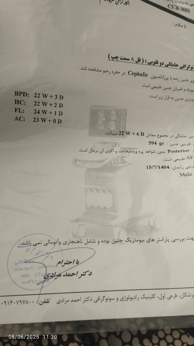 خانم دکتر وخانمایی که دوقلو باردارین بیاید لطفا نگرانم!! خانم دکتر وخانمایی که دوقلو باردارین بیاید لطفا نگرانم!!