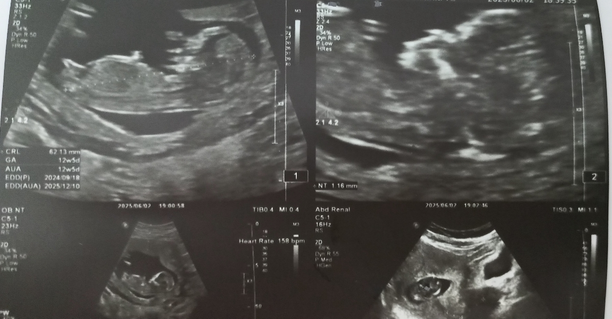 سلام خانمایی که تازه مثبت شدن🥰😘 مامانای آذر ۱۴۰۴ 🤰🤱 سلام خانمایی که تازه مثبت شدن🥰😘 مامانای آذر ۱۴۰۴ 🤰🤱