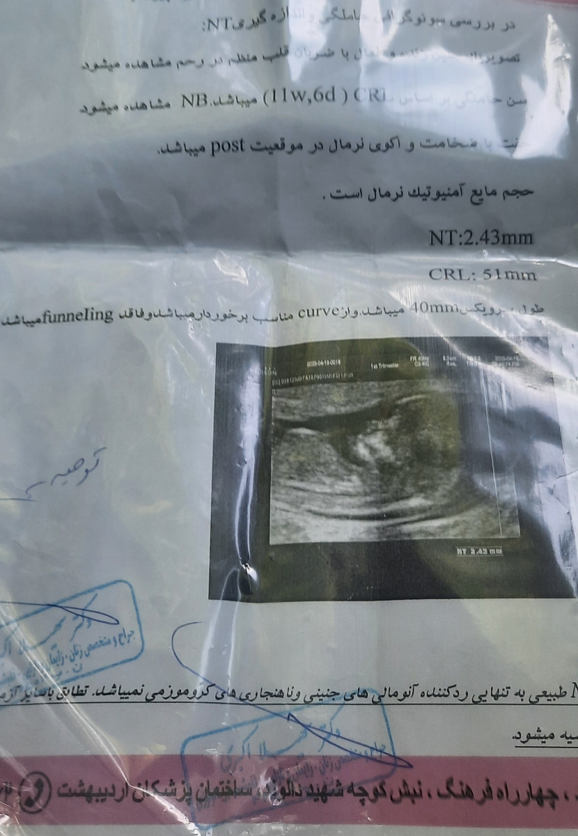 ازمایش قندخون دوساعته برای بارداری ازمایش قندخون دوساعته برای بارداری