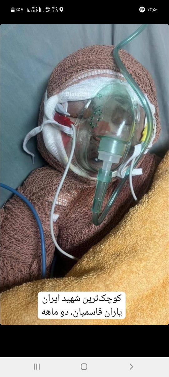 مرگ بر اسرائیل 😭😭😭بمیرم برای این دردی که کشید یمیرم برای مادرت مرگ بر اسرائیل 😭😭😭بمیرم برای این دردی که کشید یمیرم برای مادرت