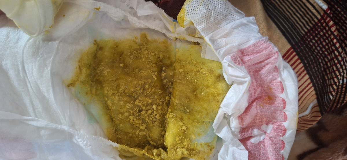 مدفوع نوزاد پنج ماهه مدفوع نوزاد پنج ماهه