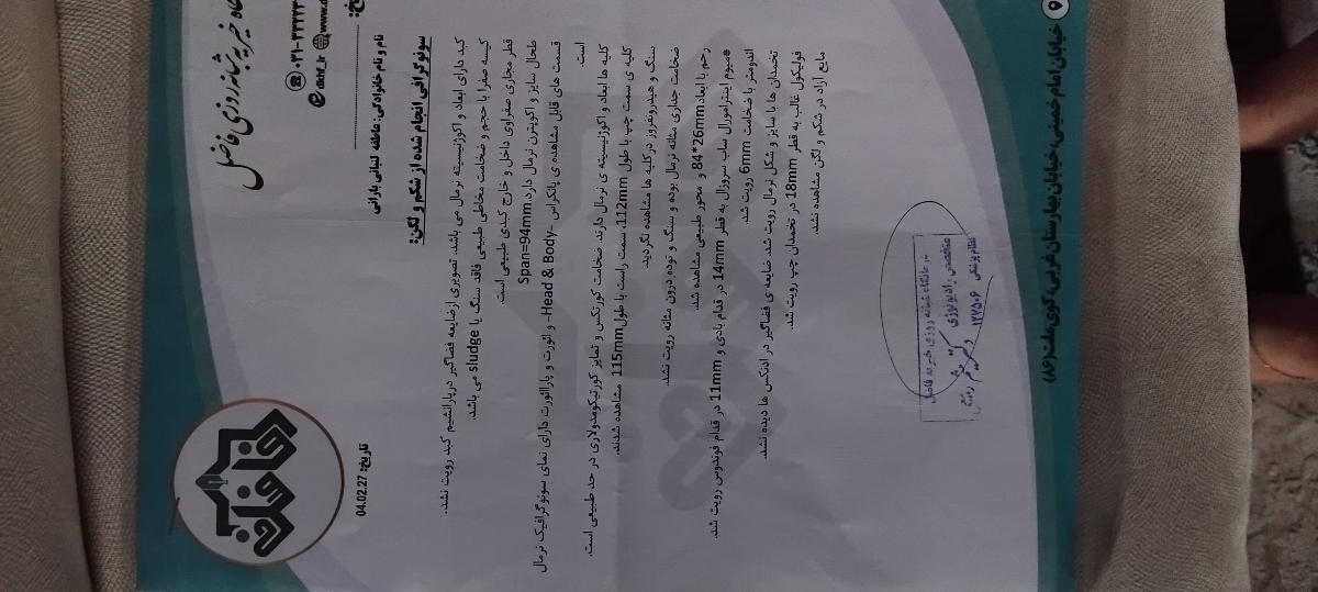 علت گرفتگی شکم و زیر دلم علت گرفتگی شکم و زیر دلم