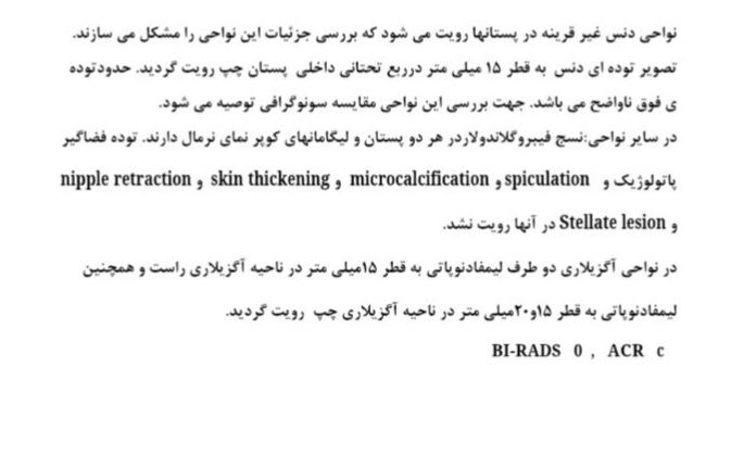 تفسیر سونوگرافی و ماموگرافی سینه+عکس تفسیر سونوگرافی و ماموگرافی سینه+عکس