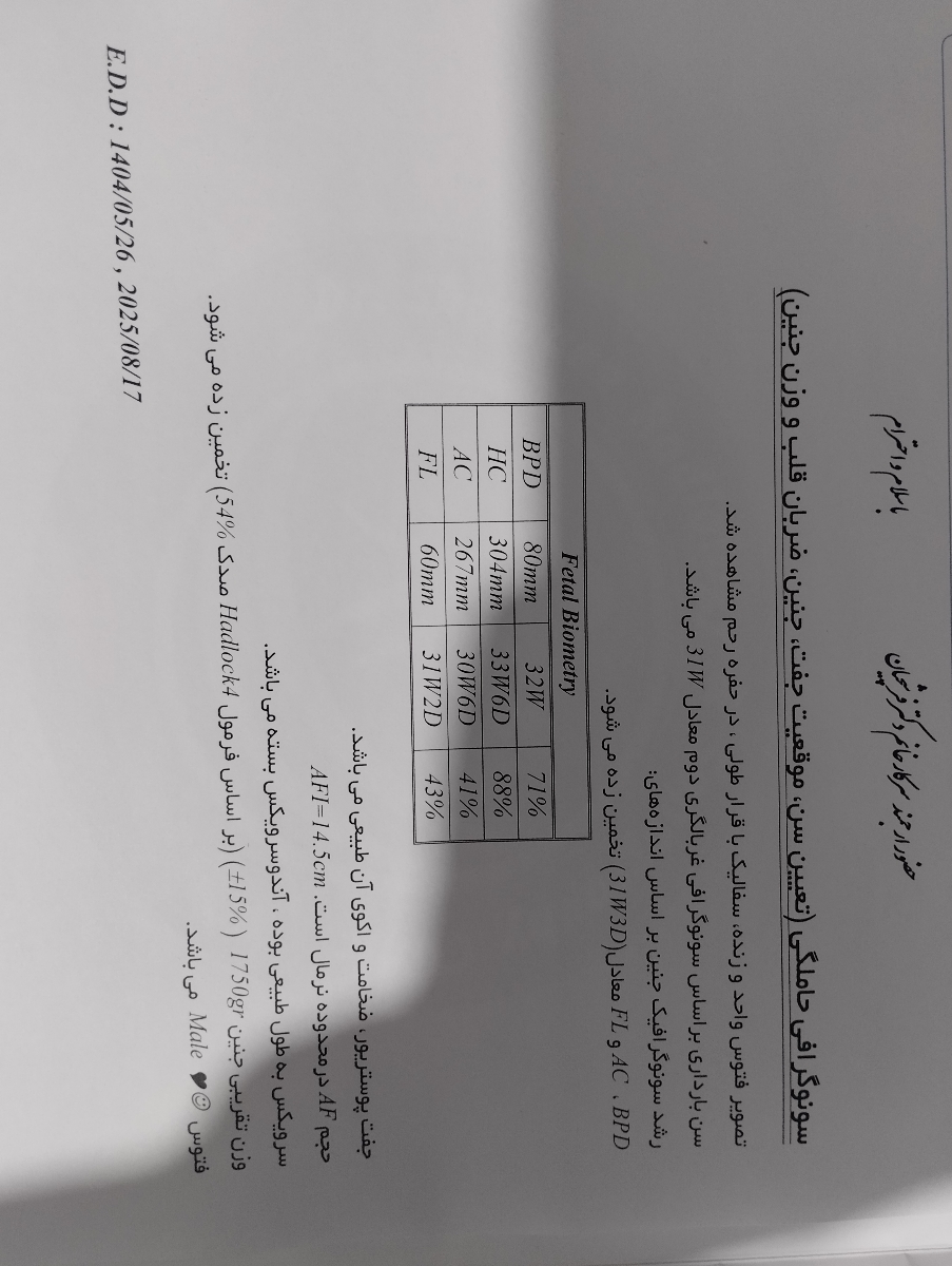 سونو وزن در ۳۰ هفته سونو وزن در ۳۰ هفته