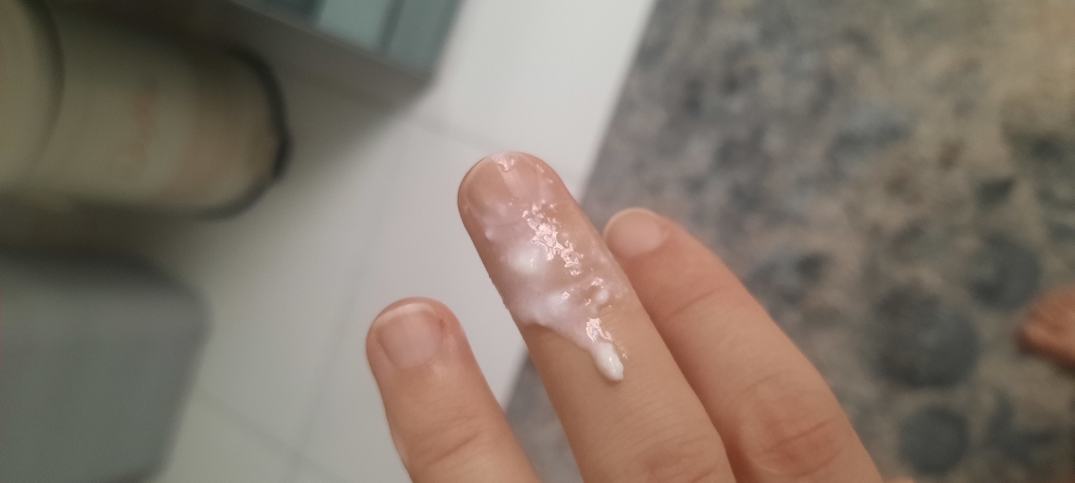 عفونت و سوزش در بارداری./عکس عفونت و سوزش در بارداری./عکس