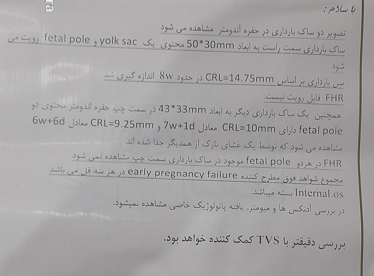ایست قلبی جنین وسقط ایست قلبی جنین وسقط