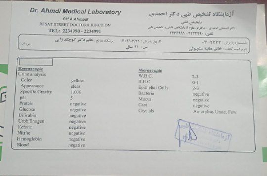 تفسیر ازمایش دفع پروتئین