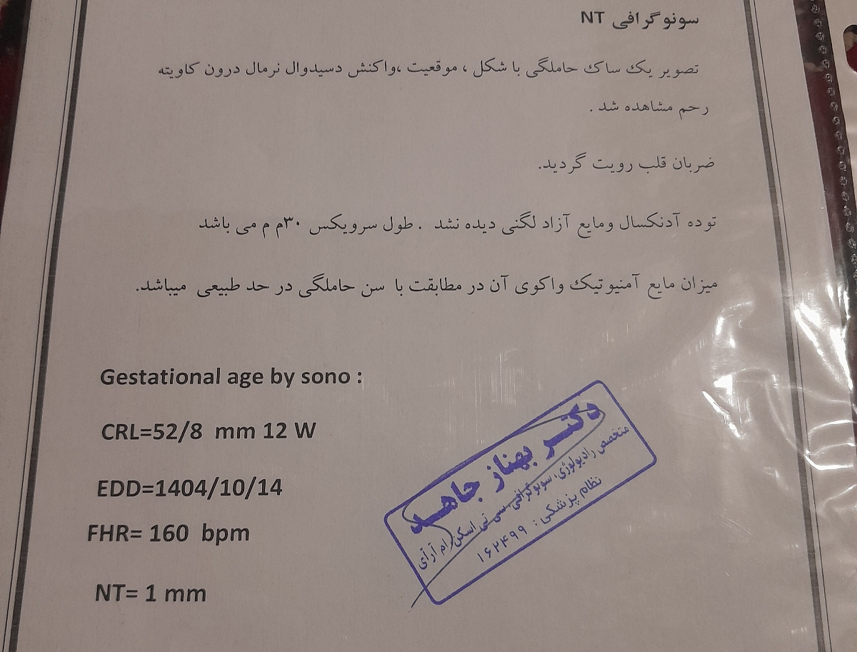 سونو گرافی ان تی سونو گرافی ان تی