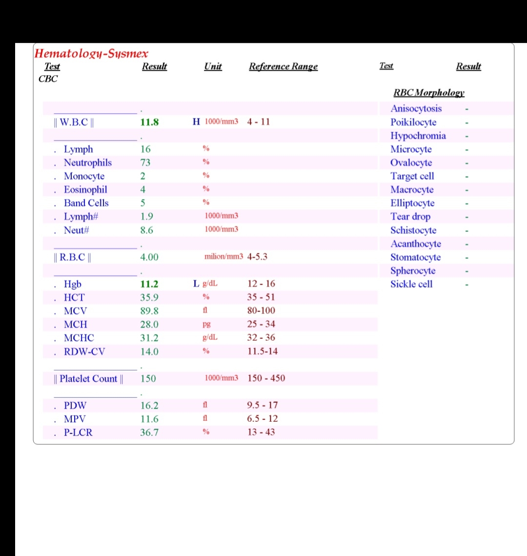 تفسیر آزمایش هفته ۲۵