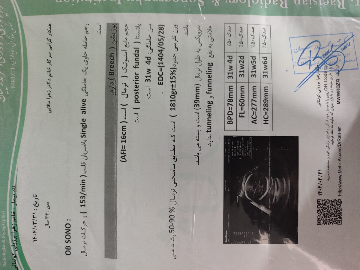 سونو وزن جنین
