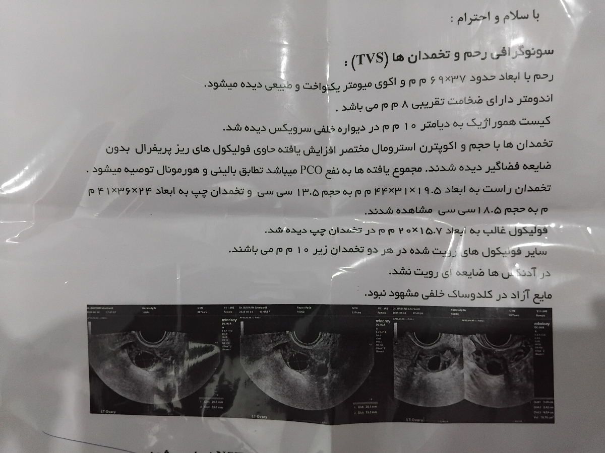 زمان تزریق آمپول آزادسازی زمان تزریق آمپول آزادسازی