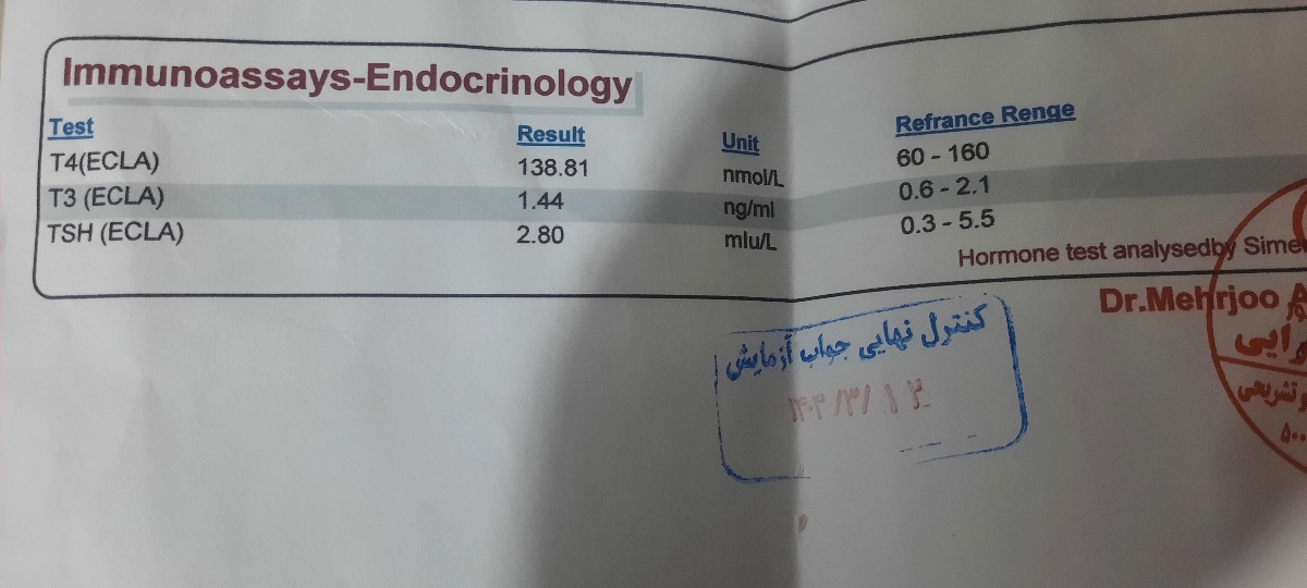 تیرویید کم کار در آزمایش تیرویید کم کار در آزمایش
