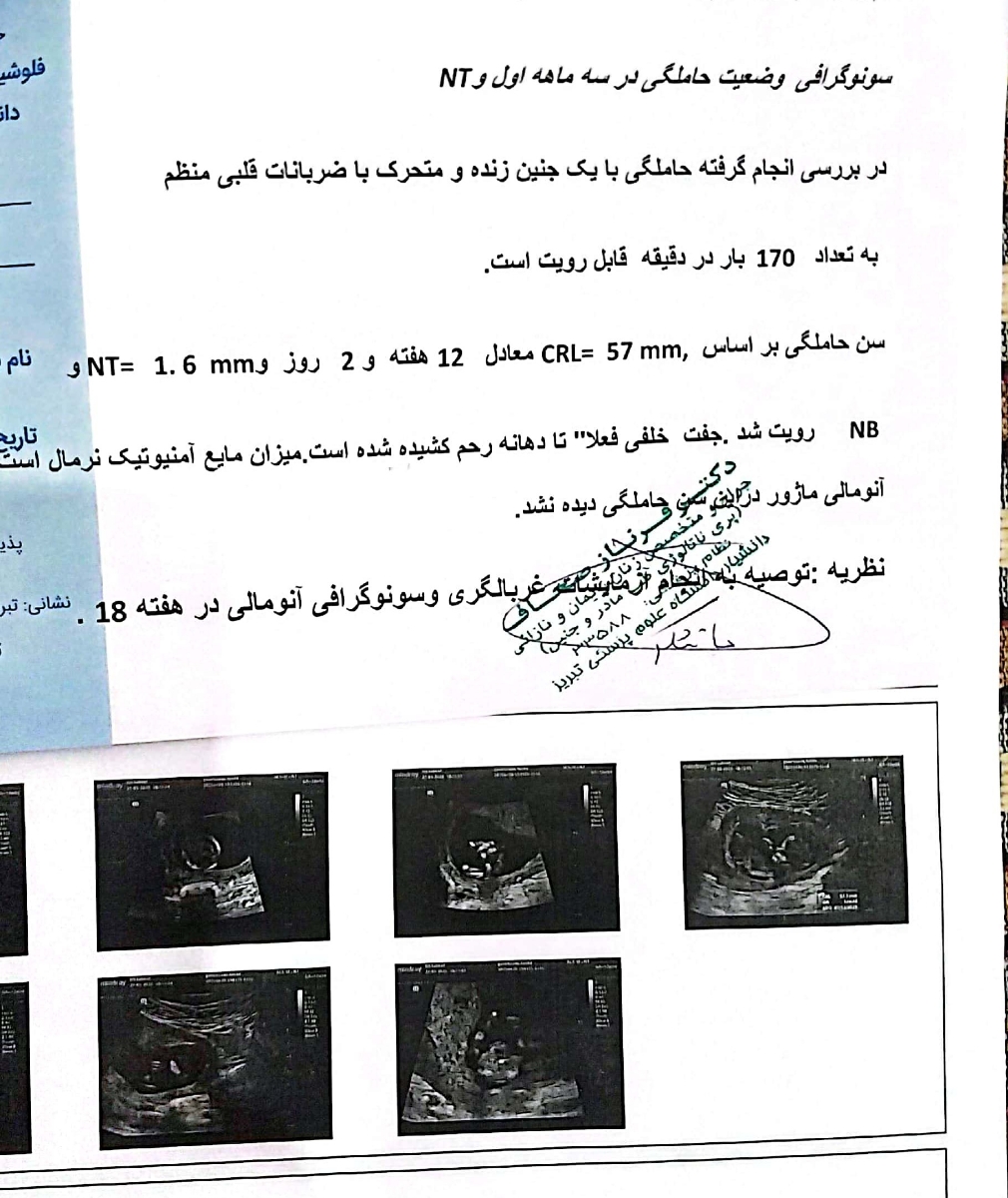 لک صورتی در هفته ۱۷ ام لک صورتی در هفته ۱۷ ام