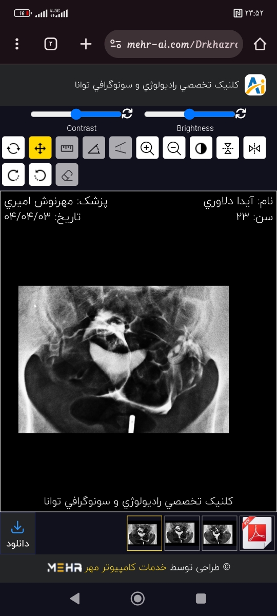 تفسیر سنو و عکس رنگی رحم