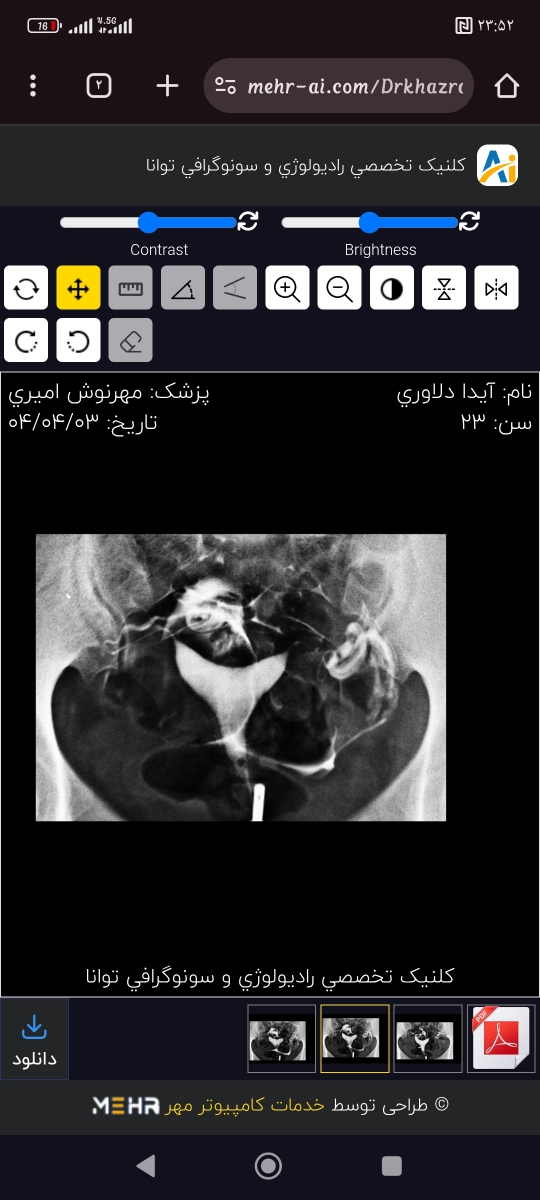تفسیر سنو و عکس رنگی رحم