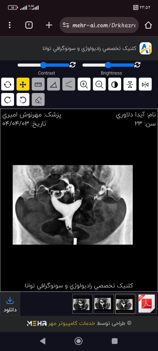 تفسیر سنو و عکس رنگی رحم