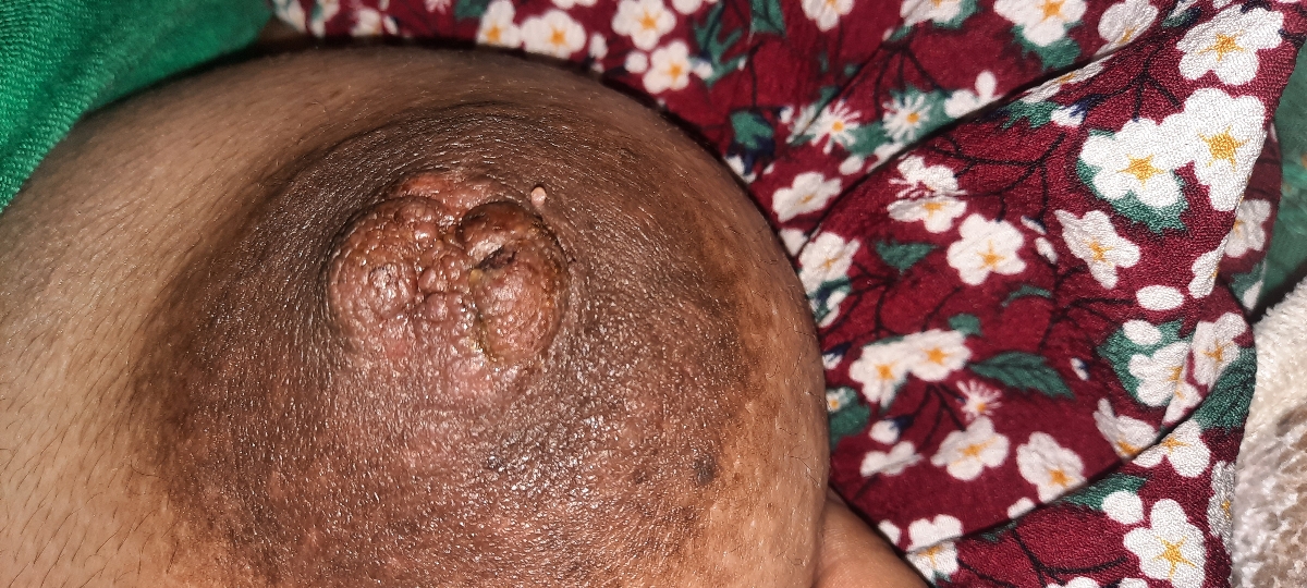 شیردهی به نوزاد