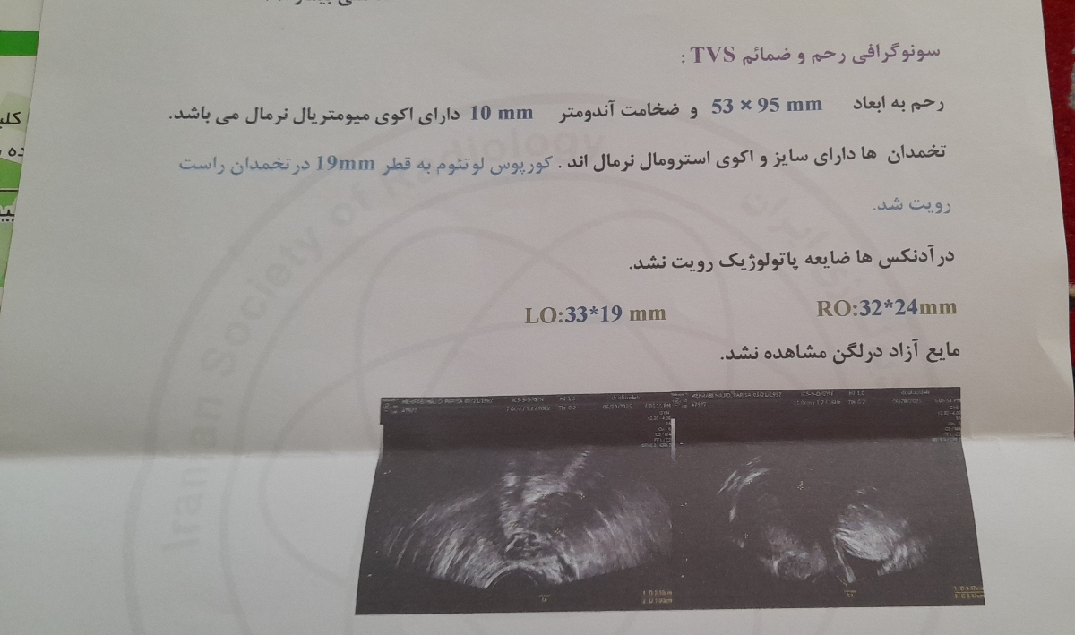 سلام بی زحمت جواب آزمایشارو میگین