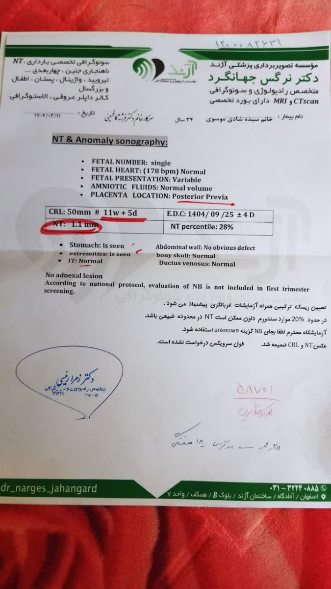 سونو و آزمایش ان تی سونو و آزمایش ان تی