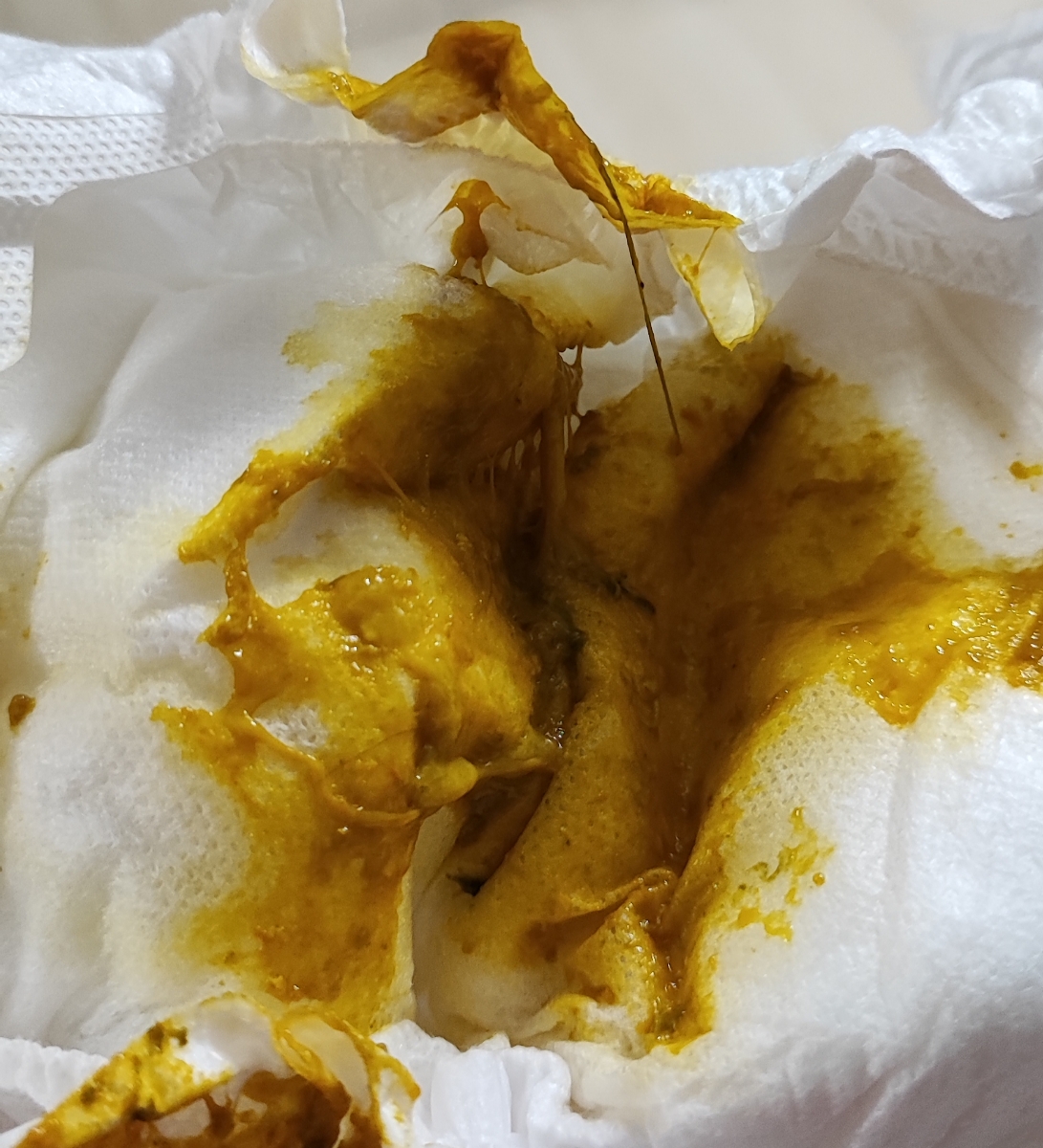 عکس مدفوع نوزاد ۲ماهه