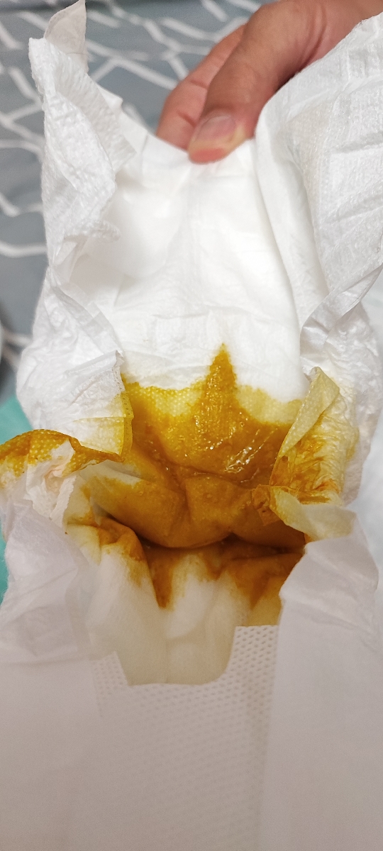 عکس مدفوع نوزاد ۲ماهه