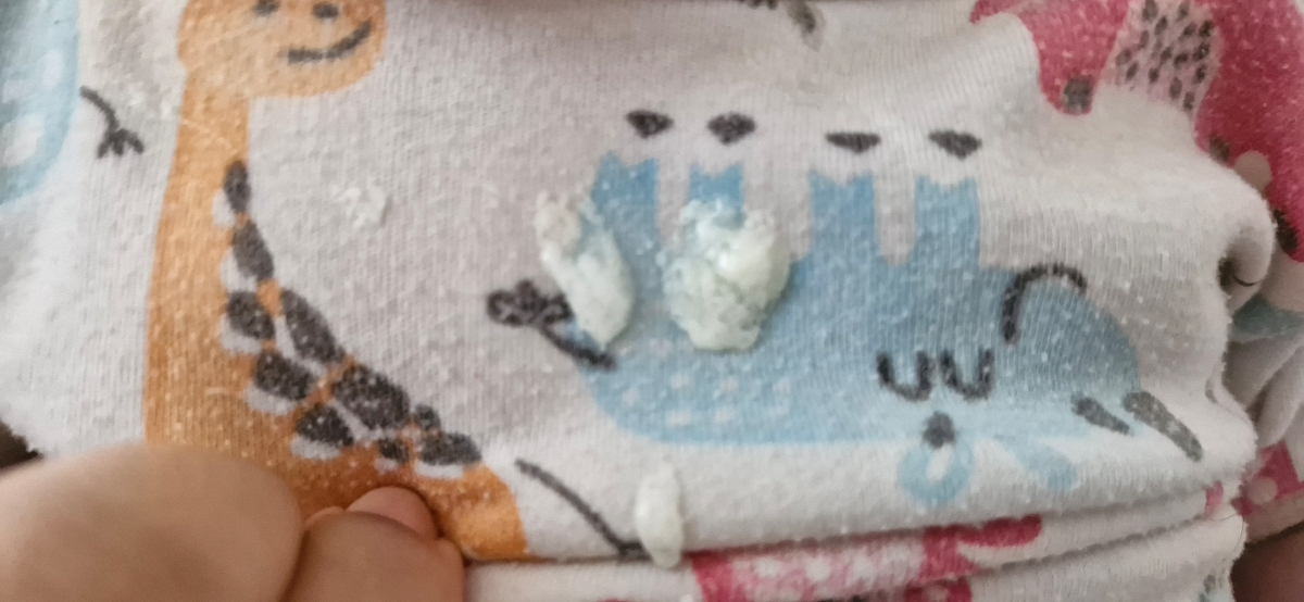 شیربالا آوردن خلطی نوزاد