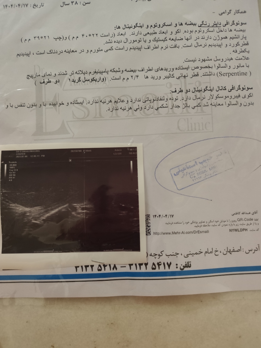 پزشک عزیز لطفا سونوی شوهرم را بررسی میکنید